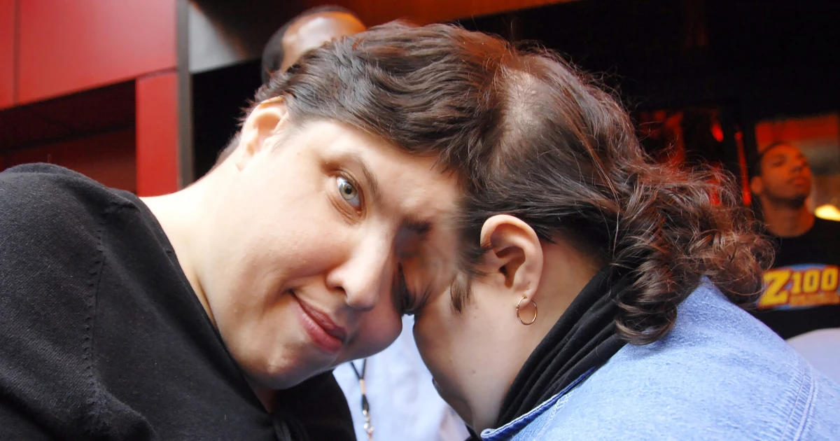 Oldest Living Conjoined Twins, Lori And George Schappell Of Reading, Dead At 62.”